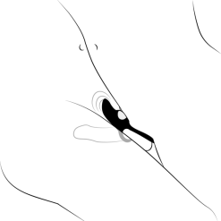 Sinful Melt Vibrerende Fjernstyrt Penisring -Par Sexleketøy butikk 23452 sinful melt rechargeable remote vibrating couple s cock ring 10 illustration q100