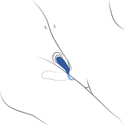 Sinful Business Blue Oppladbar Vibrerende Penisring 11 Sinful Business Blue Oppladbar Vibrerende Penisring -Par Sexleketøy butikk 25948 sinful business blue rechargeable vibrating love ring q100