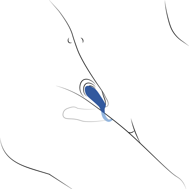 Sinful Business Blue Oppladbar Vibrerende Penisring 4 Sinful Business Blue Oppladbar Vibrerende Penisring - Bilde 4